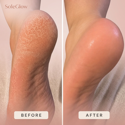 SoleGlow™ - Be Your Own Pedicure